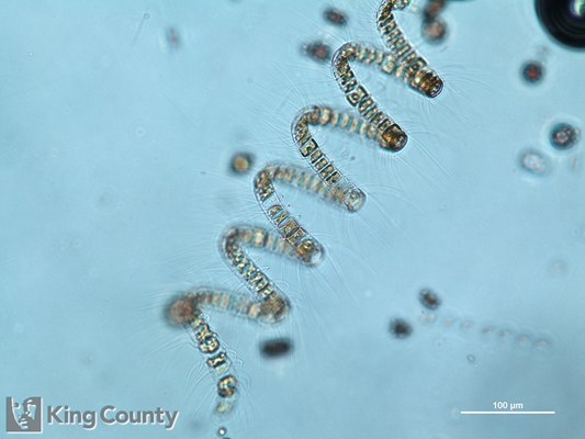 Photo of Chaetoceros debilis